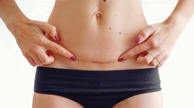 Say Goodbye to Scars: Discover the Magic of Silicone Scar Sheets!