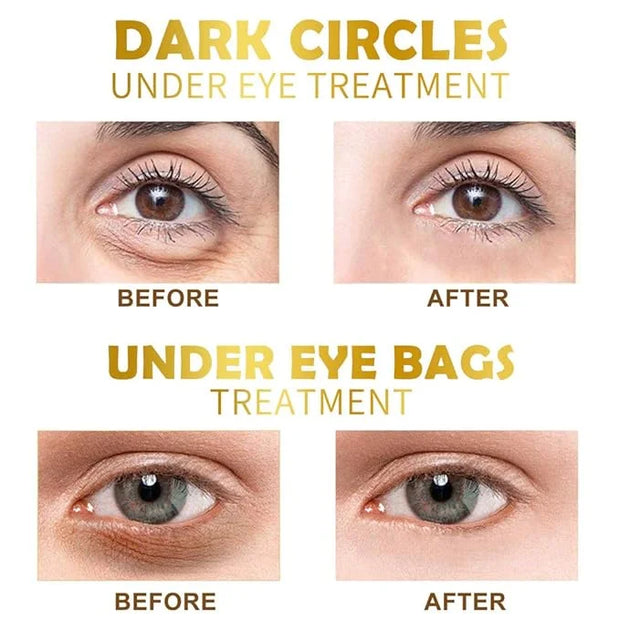 Under Eye Patches, 30 Pairs Gold Eye Mask, Eye Gel Pads With Collagen Treatment for Reducing Dark Circles, Lighten Wrinkle...