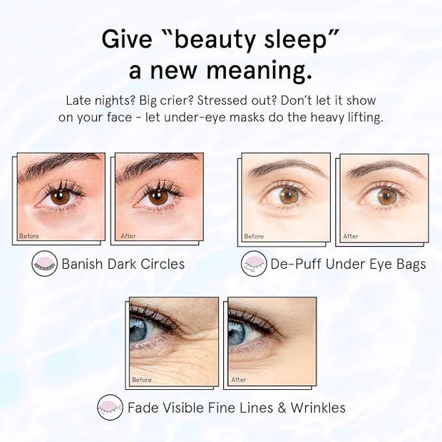 grace & stella Under Eye Patches for Puffy Eyes and Dark Circles (Retinol, 24 Pairs) Restoring Gel Under Eye Masks with Hy...