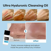 coxir Ultra HYALURONIC Starter KIT/Cleansing Oil+Toner+ampoule+Cream tralvel kit/[2.68 fl.oz (Pack of 1)] / Korean Skin Ca...