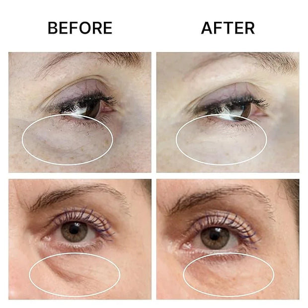 PUFFINESS AWAY Eye Cream 0.8 fl.oz - Instant Eye Bag Remover Puffiness with Eyeliss; Vitamin C, Under Eye Puffiness Reduce...