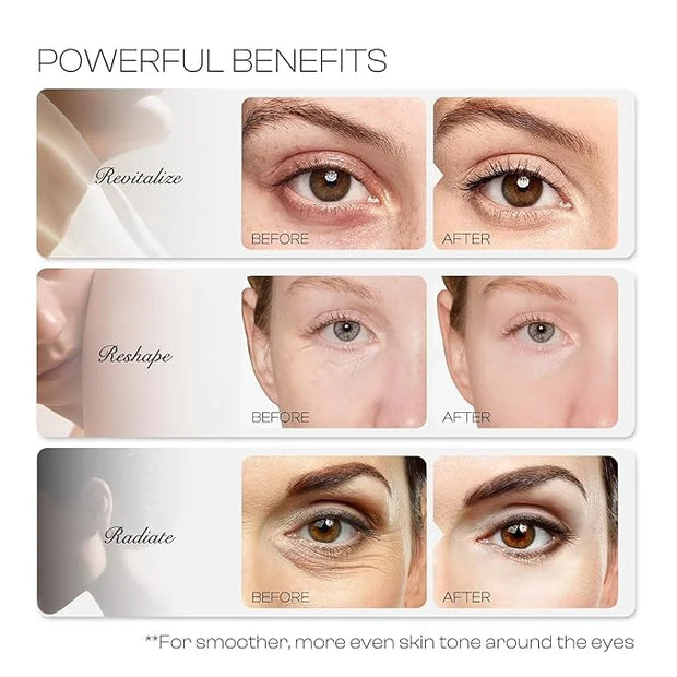 6% Caffeine Eye Cream: Dark Circle Remover Hydrating Anti-Wrinkle Eye Care Cream for Women 20ml 0.68fl.oz - Product Image