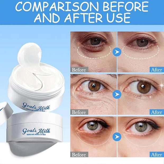 Under Eye Patches for Dark Circles & Puffy Eyes - 60 Pairs Hydrating Eye Mask with Hyaluronic Acid,Hydrolyzed Elastin&Goat...
