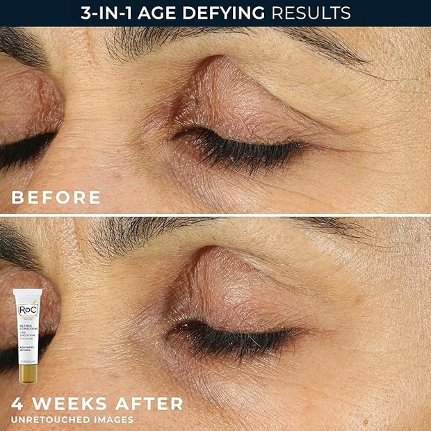 RoC Retinol Correxion Value Set Duo, Deep Wrinkle Anti-Aging Night Face Cream + Daily Under Eye Cream for Dark Circles & P...