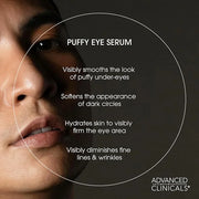 Advanced Clinicals Puffy Eye Under Eye Serum | Visible Anti Aging Brightening Vitamin C + Caffeine Serum Helps Improve Loo...