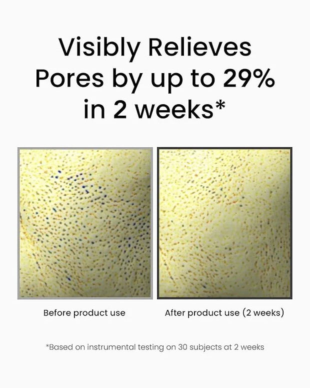 Korean Retinol Serum for Face (1fl oz) – Youth Rejuvenating Face Ampoule for Improving Fine Lines & Reducing Pigmentation,...