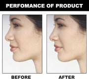 Jaw Exerciser for Men & Women Gokano Jawline - Product Image