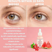 Nature Spell Advanced Under Eye Serum with Watermelon & Goji Berries 1 Fl Oz– Targets Dark Circles, Puffiness & Eyebags – ...
