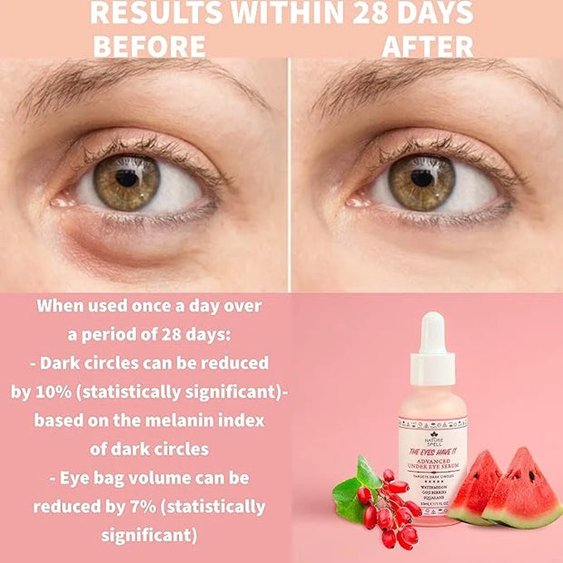 Nature Spell Advanced Under Eye Serum with Watermelon & Goji Berries 1 Fl Oz– Targets Dark Circles, Puffiness & Eyebags – ...