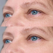 Retinol Eye Cream for Dark Circles & Wrinkles - Advanced Night Repair Treatment with Hyaluronic Acid & Vitamin E | Reduces...