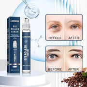 Caffeine Eye Serum for Dark Circles, 3 PCS Under Eye Ice Roller Serum for Anti Aging, Puffiness, Fine Lines, Wrinkles, Car...