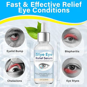 Stye Eye Treatment, Natural Stye Treatment Serum for Styes Chalazion and Blepharitis, Mild & Fast Relief - Product Image