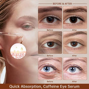 Caffeine Solution 5% + EGCG For Dark Circles & Puffiness, 30ML Anti Aging Under Eye Serum For Eye Bags, Fine Lines, Moistu...