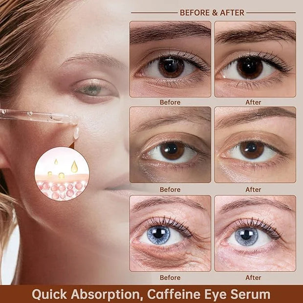 Caffeine Solution 5% + EGCG For Dark Circles & Puffiness, 30ML Anti Aging Under Eye Serum For Eye Bags, Fine Lines, Moistu...
