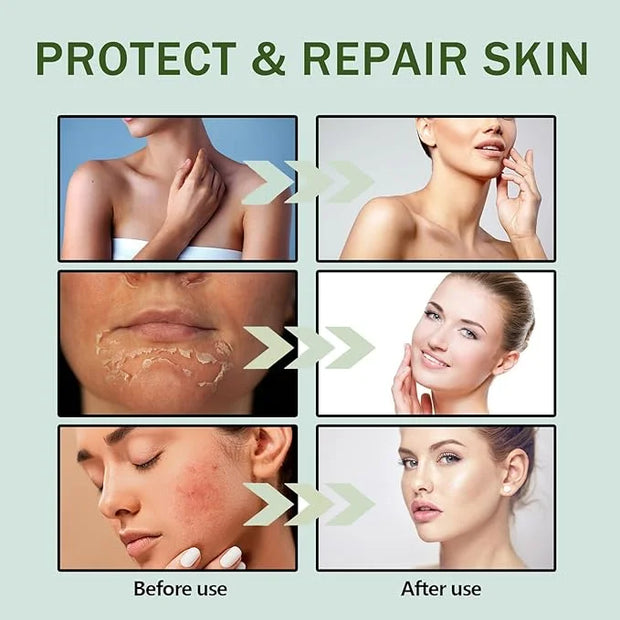 𝐶𝑒𝑛𝑡𝑒𝑙𝑙á Korean Sunscreen Calming Moisture Daily Sunscreen SPF 50+ PA++++, Facial Sunscreen for Women, Water-fit Sun Serum...