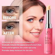 Instant Eye Bag Remover, Retinol Eye Cream for Dark Circles, Under Eye Brightener Stick, Under Eye Cream Anti Aging, Eye C...