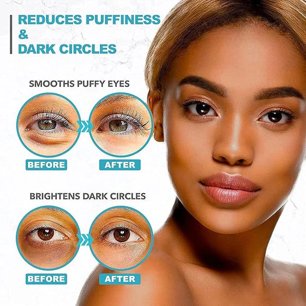 Under Eye Patches For Puffy Eyes And Dark Circles - Retinol Collagen Under Eye Masks - Reduce Wrinkles & Bags - Skin Treat...