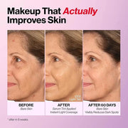 Revlon Illuminance Tinted Serum, Triple Hyaluronic Acid, Evens Out Skin Tone Over Time and Hydrates All Day, SPF 15, 213 L...