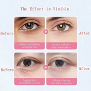 Under Eye Patches for Dark Circles, Puffiness and Eye Bags, Eye Mask,Wrinkle Treatment Anti-Aging Rejuvenating Moisturizin...