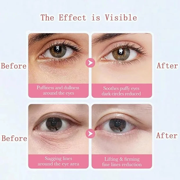 Under Eye Patches for Dark Circles, Puffiness and Eye Bags, Eye Mask,Wrinkle Treatment Anti-Aging Rejuvenating Moisturizin...