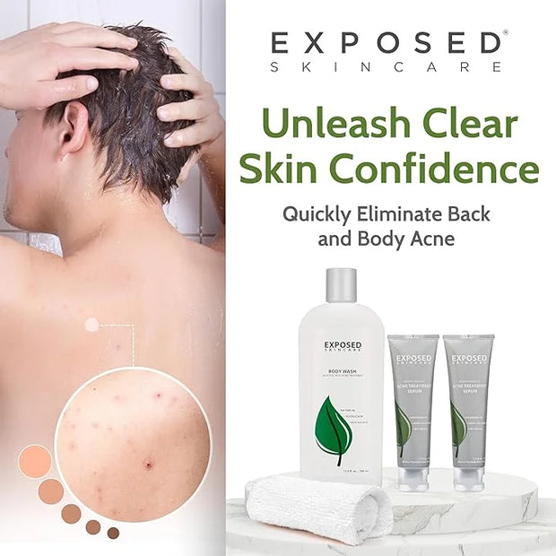 Exposed Skin Care Body Acne Kit – Dual Acne Treatment Serums + Body Wash and Exfoliating Body Cloth – Powerful System Elim...