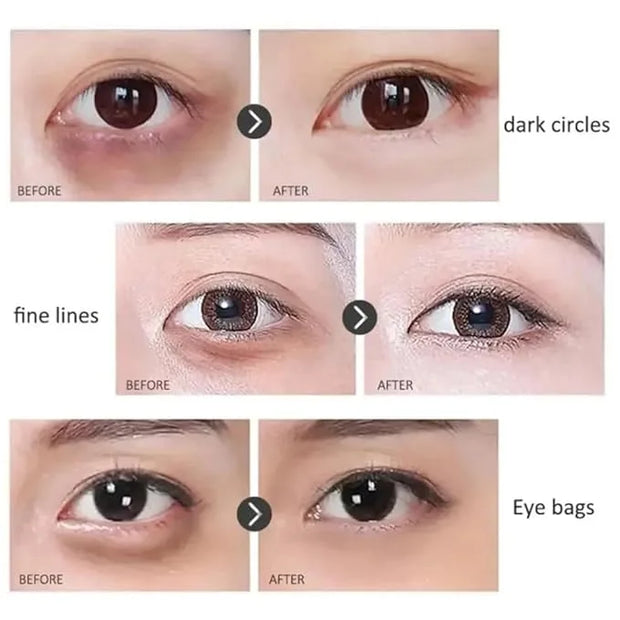 Retinol Anti-Wrinkle Eye Serum Oil, Eye Oil Roller, Reduces Fine Lines, Anti Wrinkle Serum For Eye - Product Image