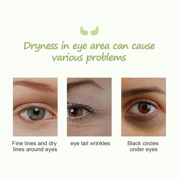 12Pcs Under Eye Patches for Dark Circle, Cucumber Moisturizing Hyaluronic Acid Eye Mask, Crystal Angle Wings Mask, Hrydrat...