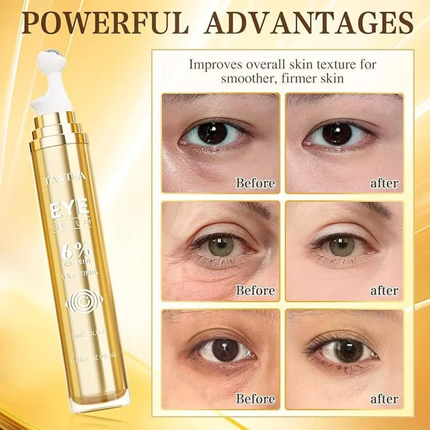 6% Caffeine Eye Cream for Puffy Eyes & Dark Circles, 1% Retinol Eye Serum for Under Eye Bags, Anti-Aging Eye Treatment for...