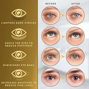 Under Eye Patches (72 Patches) for Puffy Eyes and Dark Circles with Pure Collagen, 24K Gold Eye Gel Pad Masks for Reducing...