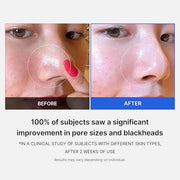 Medicube Zero Pore Pads 2.0, Dual-Textured Facial Toner Pads for Exfoliation and Pore Care with 4.5% AHA Lactic Acid & 0.4...