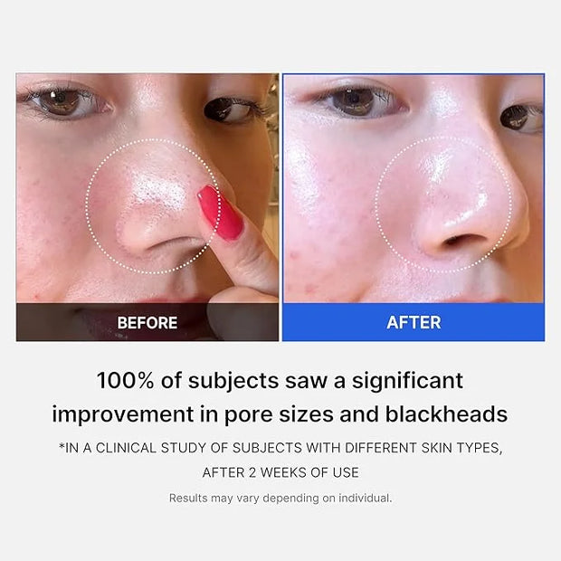 Medicube Zero Pore Pads 2.0, Dual-Textured Facial Toner Pads for Exfoliation and Pore Care with 4.5% AHA Lactic Acid & 0.4...