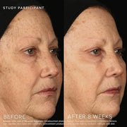 Rodan + Fields Reverse Regimen: Cleanser, Toner, Lotion SPF 50, & Treatment | Daily Moisturizer | Contains Vitamin C & Ret...