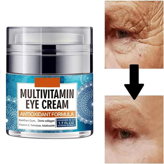 Eye Cream for Women, Multivitamin Eye Cream Under Eye Cream for Dark Circles Anti Aging and Wrinkle Deeply Moisturizing Re...