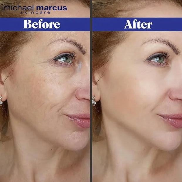 Micheal Marcus Hydromarine™ Eye Lift Serum - Reduces Wrinkles, Puffiness, Fine Line & Dark Circles - Under Eye Serum Impro...