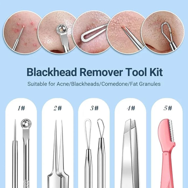 TsMADDTs Blackhead Remover Tools, Ingrown Hair Tweezers, Pimple Popper Tool Kit, Blackhead Extractor, Eyebrows Tweezers fo...