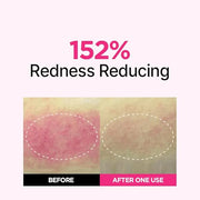 ISOI Blemish Care Up Serum Triple Set, Korean Skin Care for Glass Skin Radiance, Includes 2 Full Size & 1 Refill Serums, E...