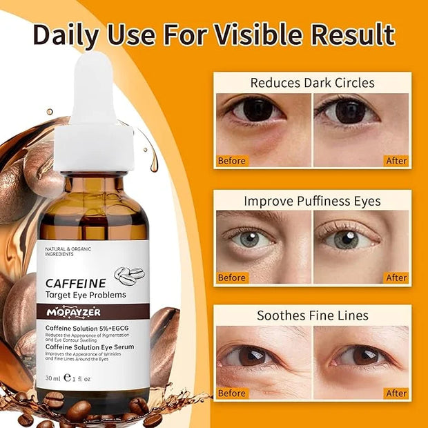 Caffeine Solution 5% + EGCG, Caffeine Eye Serum For Moisturizing, Targets Dark Circles & Puffiness, 2 PCS Natural Under Ey...