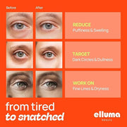 Under Eye Patches 12 Pairs of Themed Hydrogel Eye Gel Pads - For Puffy Eyes and Dark Circles, Under Eye Bags, Wrinkles - E...