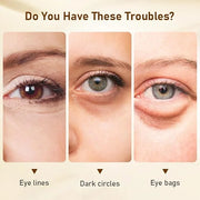 Niacinamide Eye Cream for Dark Circles & Puffiness – Hydrating Under Eye Treatment for Fine Lines & Wrinkles – Firming & A...