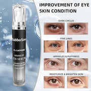 5% Caffeine Eye Serum, Anti-Aging Eye Cream with 360°Massage Roller, Eye Serum for Dark Circles and Puffiness, Reduces Fin...