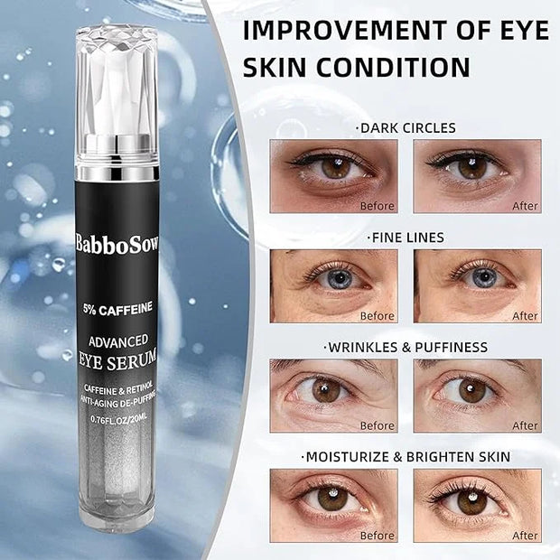 5% Caffeine Eye Serum, Anti-Aging Eye Cream with 360°Massage Roller, Eye Serum for Dark Circles and Puffiness, Reduces Fin...