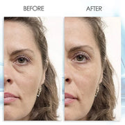 Puffy Eye GEL Instant results – Naturally rapid reduction eye gel, Eliminate Wrinkles, Puffiness and Bags – Hydrating Eye ...