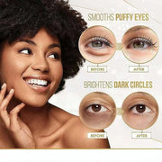 Hyaluronic Acid Eye Patch (Removes Dark Circles, Eye Bags, Eye Care, Wrinkles, Puffy Eyes, Skin Cushioning) - Anti-Aging M...