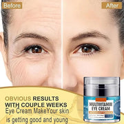 Eye Cream for Women, Multivitamin Eye Cream Under Eye Cream for Dark Circles Anti Aging and Wrinkle Deeply Moisturizing Re...