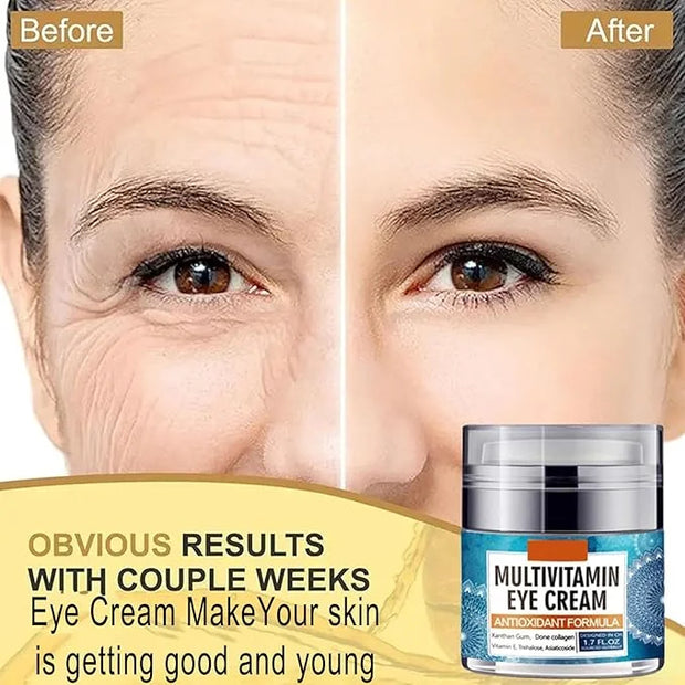 Eye Cream for Women, Multivitamin Eye Cream Under Eye Cream for Dark Circles Anti Aging and Wrinkle Deeply Moisturizing Re...