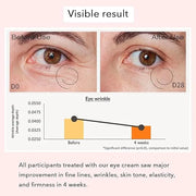 Revive Eye Serum, Anti-Aging Cream Eye Treatment, Visibly Smoothes Fine Lines, Daily Serum, Korean Skin Care, 30ml, 1 fl.o...
