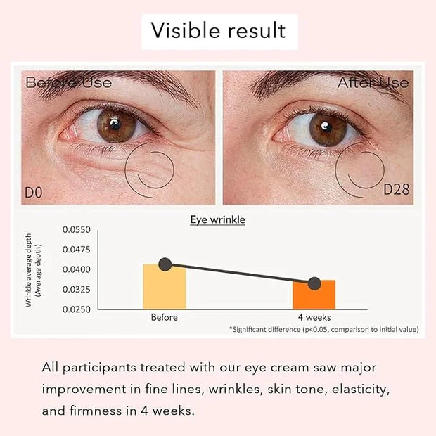 Revive Eye Serum, Anti-Aging Cream Eye Treatment, Visibly Smoothes Fine Lines, Daily Serum, Korean Skin Care, 30ml, 1 fl.o...