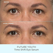 Pacifica Future Youth Time Shift Eye Serum – Peptide Eye Serum for Fine Lines & Dark Circles, Lifting & Firming Under Eye ...