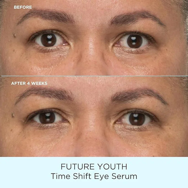 Pacifica Future Youth Time Shift Eye Serum – Peptide Eye Serum for Fine Lines & Dark Circles, Lifting & Firming Under Eye ...