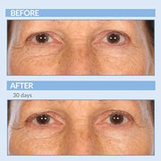 Serious Skincare - Retinol Vitamin A Eye XR Under Eye Cream Concentrate - Reduce Fine Lines, Dark Circles & Puffiness - Da...